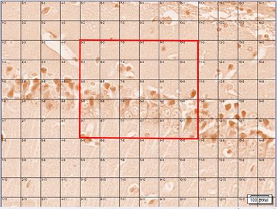 Naringin Chelates Excessive Iron and Prevents the Formation of Amyloid-Beta Plaques in the Hippocampus of Iron-Overloaded Mice